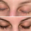 MYHAIRVITAMINS - Blakstienų Augimą Skatinantis Serumas - VITAMIN INFUSED EYELASH GROWTH SERUM - Image 4