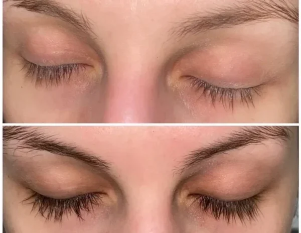 Myhairvitamins - Vitamin Infused Eyelash Serum - Image 4